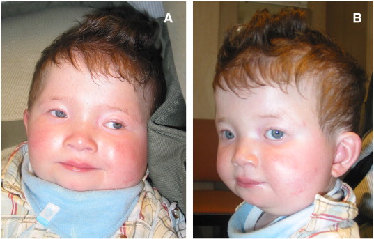 ninitest.com |    غربالگری نوزادان 